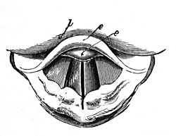 FIG. 193.—The vibration of the vocal cords produces
the sound of the human voice.